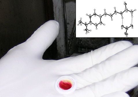 Effektiviteten af en spray med hudceller i behandlingen af trofasår