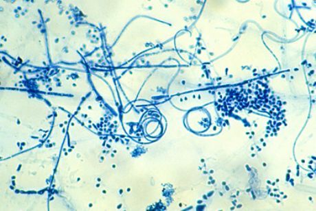 Den forårsagende middel til epidermophytosis af fødderne (Trichophyton interdigitale)